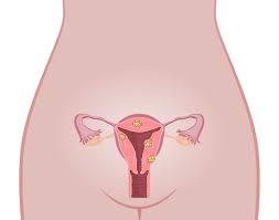 We did not find results for: Natural Ways To Shrink Fibroids Downriver Obgyn Trenton Michigan