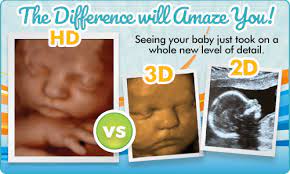 Check spelling or type a new query. 3d Ultrasound 4d Ultrasound Fayetteville Little Miracles Nc