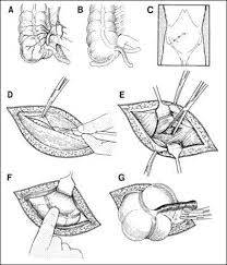 Introduction A La Chirurgie