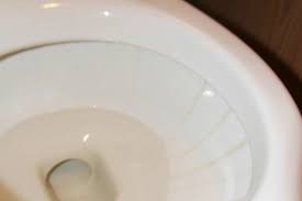 Tüm ev hanımlarının baş belası olarak görülen lavabolarda oluşan sarı. Klozetteki Sari Lekeleri Cikarmanin Kolay Yolu Hayatkolay