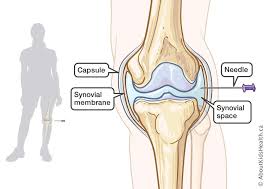 Image result for Knee Joint Injection