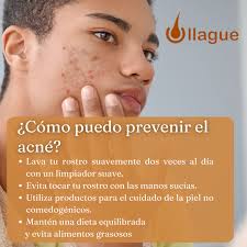 Centro de Dermatologia OLLAGUE (@dermatologosollague) • Instagram photos  and videos