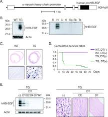 Description, photos, reviews, contacts, schedule and online booking. Diphtheria Toxin Induced Autophagic Cardiomyocyte Death Plays A Pathogenic Role In Mouse Model Of Heart Failure Journal Of Biological Chemistry