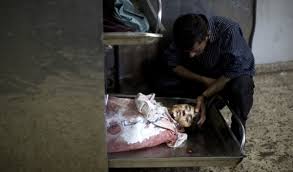 Maybe you would like to learn more about one of these? These Are The Images From Gaza That Are Too Graphic For Many Us News Outlets To Publish Day 31 The World From Prx