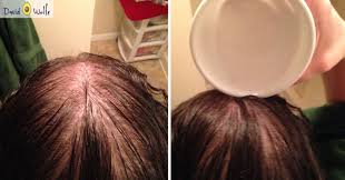 Avoid microwaving the oil to prevent it from becoming dangerously hot. How To Use Coconut Oil To Prevent Graying Balding Hair And More David Avocado Wolfe
