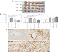 Regular grooming will assist with the early. Immunotherapy Of Bacillus Calmette Guerin By Targeting Macrophages Against Bladder Cancer In A Nod Scid Il2rg Mouse Model