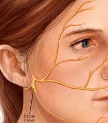 However, one possible etiology is infection with herpes simplex virus type 1. Ramsay Hunt Bell S Palsy Herpes Zoster Oticus How Do You Tell Them Apart Hhtm