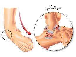 Ankle - Orthopaedic Center Of The Virginias