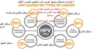 Hpv (human papillomavirus) is a sexually transmitted virus. Ø¨Ø§Ù„Ø§Ø¹Ø´Ø§Ø¨ Ø¹Ù„Ø§Ø¬ Ø§Ù„Ø«Ø§Ù„ÙŠÙ„ Ø§Ù„Ø­Ù„ Ø§Ù„Ø¬Ø°Ø±ÙŠ Ùˆ Ø§Ù„Ù†Ù‡Ø§Ø¦ÙŠ ÙˆØ¹Ù„Ø§Ø¬ Ø§Ù„ØªÙˆØ§Ù„ÙŠÙ„ Ø§Ù„Ø«Ø¢Ù„ÙŠÙ„ Ø§Ù„Ø«Ø¤Ù„ÙˆÙ„ Ø§Ù„ØªÙ†Ø§Ø³Ù„ÙŠ Ø§Ù„Ø³Ù†Ø· ÙÙŠ Ø§Ù„Ø·Ø¨ Ø§Ù„Ø¨Ø¯ÙŠÙ„ Ø¨Ø§Ù„Ø§Ø¹Ø´Ø§Ø¨ Ø¹Ù„Ø§Ø¬ Ø§Ù„Ø«Ø§Ù„ÙŠÙ„ Ø§Ù„ØªÙ†Ø§Ø³Ù„ÙŠÙ‡