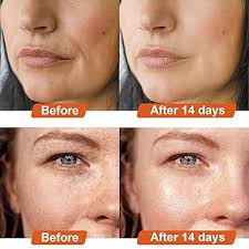 Ultra Fine Vitamin C Powder (Cosmetic Grade, 100g), Pure L-Ascorbic Acid  Powder for Face and Skin, Great for Making Fresh & Effective Vitamin C  serum (325 Mesh) : Health & Household