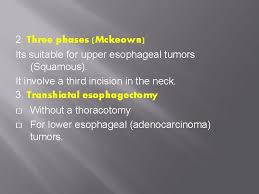 Division of cardiothoracic surgery, department of surgery university of iowa carver college of medicine iowa city usa. Neoplasms Of The Esophagus Benign Tumors Benign Epithelial
