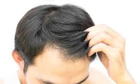 The drug's label instructs users to take one 1 milligram tablet once daily, with or without meals. Finasteride Propecia Everything You Need To Know