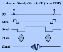 True Fisp Fiesta Questions And Answers In Mri