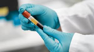 Image result for Lipase