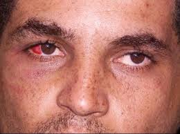 Ele foi para semiaberto em 2014, mas estava proibido de ser beneficiado por 'saidões'. It685zbkpryugm