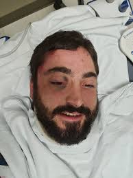 Lifting 225 lbs after a serious car accident