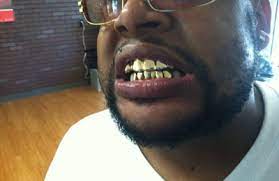 Get paid for your dental gold! Gold Teeth Specialists 4215 Cane Run Rd Louisville Ky 40216 Yp Com