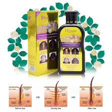 According to chinese medicine, hair loss is an indicator of bigger issues internally. 200ml Men Women Disaar Hair Shampoo Anti Hair Loss Chinese Herbal Hair Growth Buy At A Low Prices On Joom E Commerce Platform