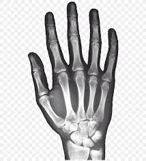 A good application to laugh with friends. X Ray Hand Carpal Bones Android Png 523x900px Xray Android Black And White Bone Bone Age