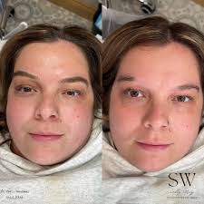 𝘉𝘳𝘪𝘯𝘨𝘪𝘯𝘨 𝘵𝘩𝘦𝘴𝘦 𝘣𝘳𝘰𝘸𝘴 𝘣𝘢𝘤𝘬 𝘵𝘰 𝘭𝘪𝘧𝘦 ✨ . #phibrows  #phibrowartist #hyperrealism #spmu #pmu #spmubrows #microblading  #microbladingeyebrows #nanoblading #phishading #browsonfleek #hairloss