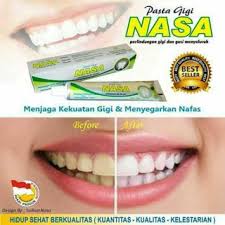 Pasta Gigi Nasa Untuk Jerawat Aman Buat Masker Dan Bisa Merontokkan Karang Gigi Mengandung Ekstrak Cengkeh Dam Tidak Berbahaya