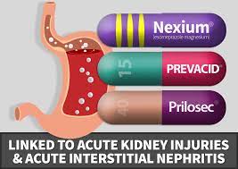 Heartburn Drug Lawsuits For Stomach Cancer Kidney Complications