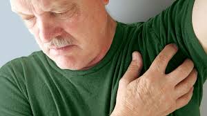 Visual Guide to Hidradenitis Suppurativa Stages and Symptoms