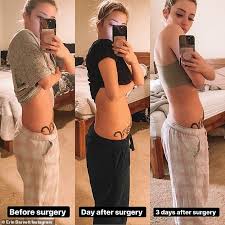 Von diesen zellen unterscheiden sich. Liebe Insel Erin Barnett Erholt Sich Nach Ihrer Sechsten Operation Fur Endometriose Aktuelle Boulevard Nachrichten Und Fotogalerien Zu Stars Sternchen