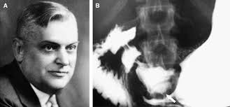 People Behind Exclusive Eponyms of Radiologic Signs (Part I)