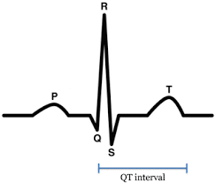 Image result for QT Interval