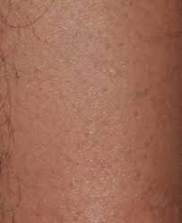 Our dayton laser hair removal team of specialists are standing by and ready to answer all of your questions. Laser Hair Removal Cosmetic Services By Mvl Dayton Ohio