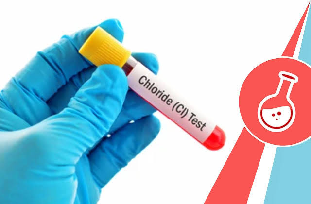 CHLORIDE product image