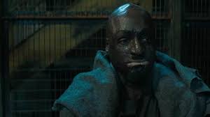 Who is Henry Sickler? What Happened to His Face and Hands? Who Plays Him?