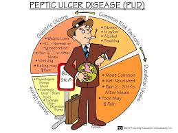 Peptic Ulcer Disease Nursing Information Medical Surgical Nursing Nursing School