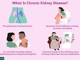 Chronic renal failure, also called chronic kidney disease, nursing nclex review lecture on the pathophysiology, symptoms, stages. Chronic Kidney Disease Coping Support And Living Well