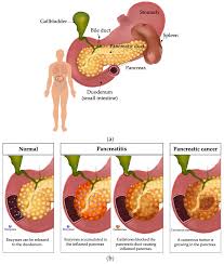 Image result for pancreas)