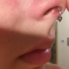 Septum Bumb Do You Know What Is This Piercing