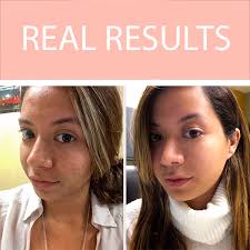 Real-Results_Michelle-compare_600_600x600.jpg?v=1590172068