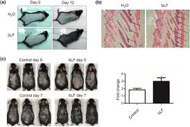It is the first hair nourishing serum product in thailand with mulberry extract that has been. Lactoferrin Promotes Hair Growth In Mice And Increases Dermal Papilla Cell Proliferation Through Erk Akt And Wnt Signaling Pathways Springerlink