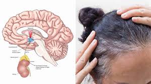 They found that stress causes the stem cells to leave our hair follicles, leaving hair gray or white. Science Explains The Link Between Stress And Gray Hair