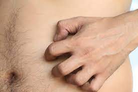 Itchy Stomach Causes Symptoms And Treatment