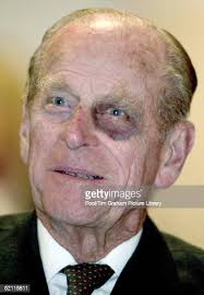 11. The “Black Eye” Club