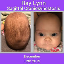 I Do Not Ever Come To Fb Nor Do I Post My Personal Business All Like That ,  But We Are Going In For Surgery Today , For The People Who Do