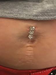 Question About A Re Piercing I Had Two Navel Piercings The Bottom One Has Been Healed 8 9 Years I Also Had Surgery Where They Cut Through My Navel 6 Years Ago Allis