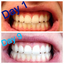 Pin On Household Ideas