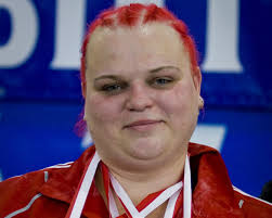 Dramatyczne wieści o Agacie Wróbel. Utrata wzroku i walka o pomoc dla  zwierząt :: RMF FM