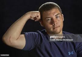 291 Tommy John Surgery Stock Photos, High-Res Pictures, and Images