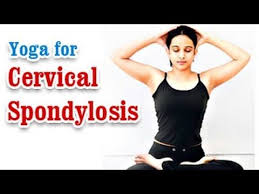 Pin On Cervical Spondylosis