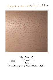 مسام الأرجل شعر تحت الجلد رؤوس سوداء Insta