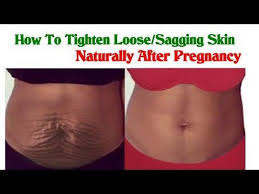 Pin On Excess Belly Fat